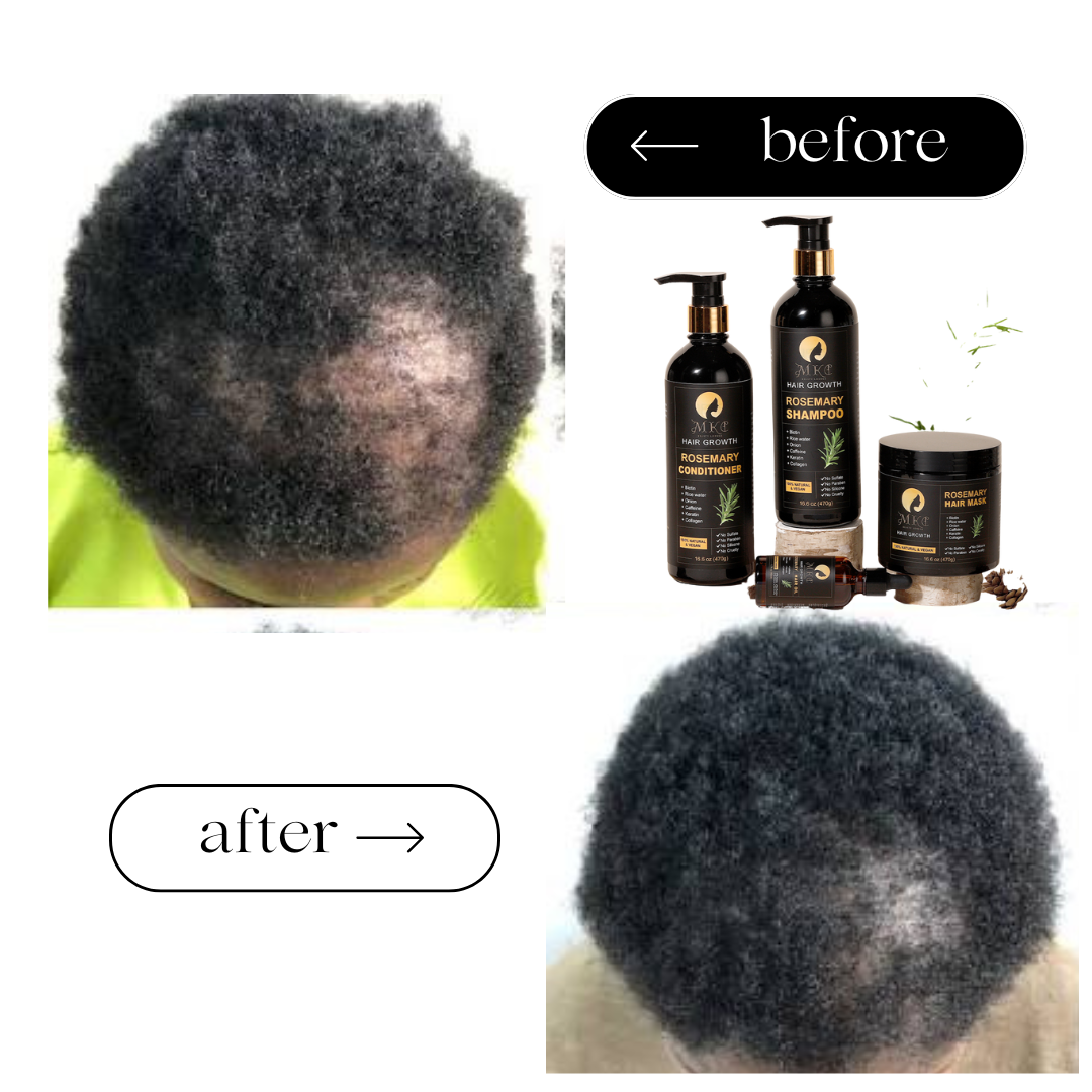 Rosemary Hair Care Set