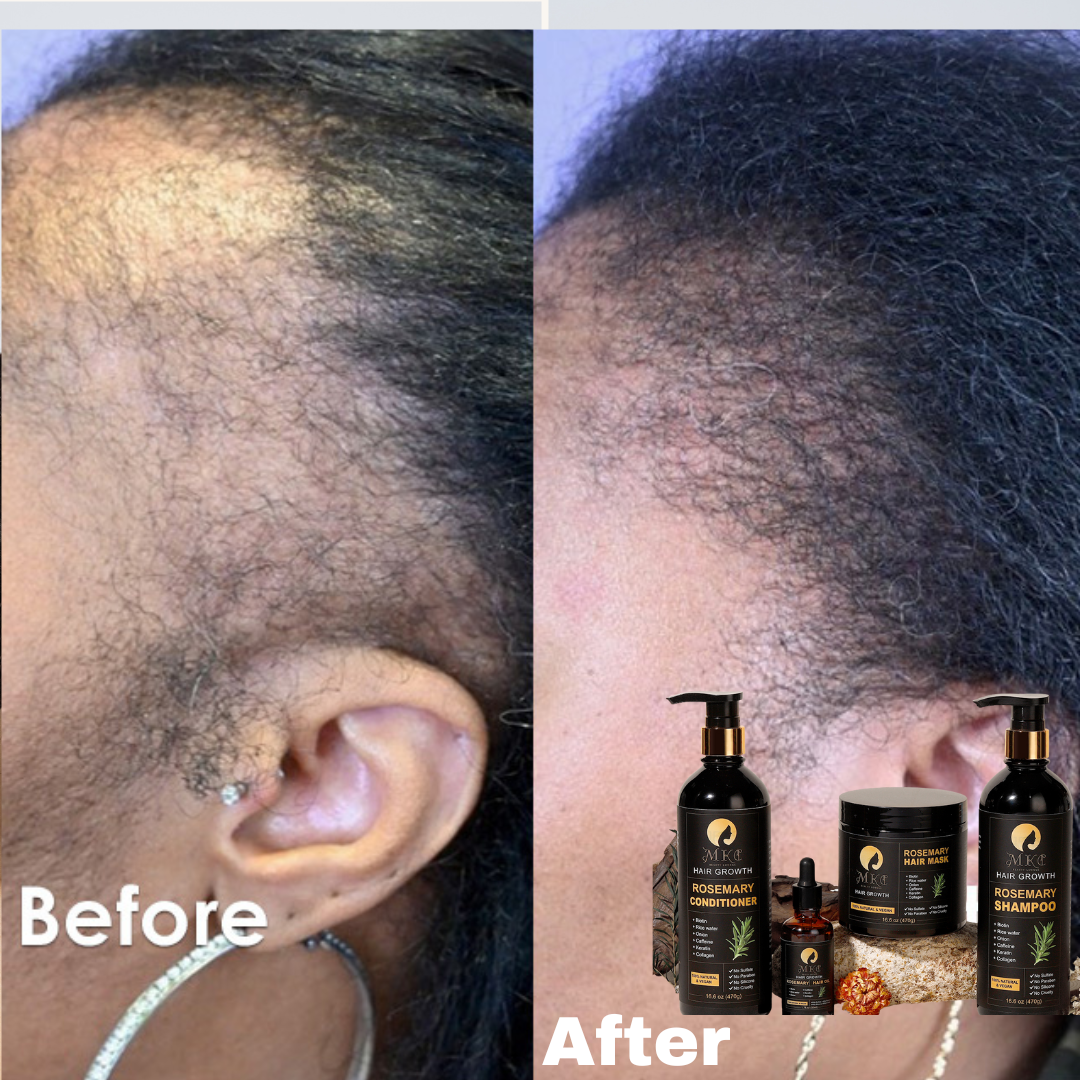 Rosemary Hair Care Set