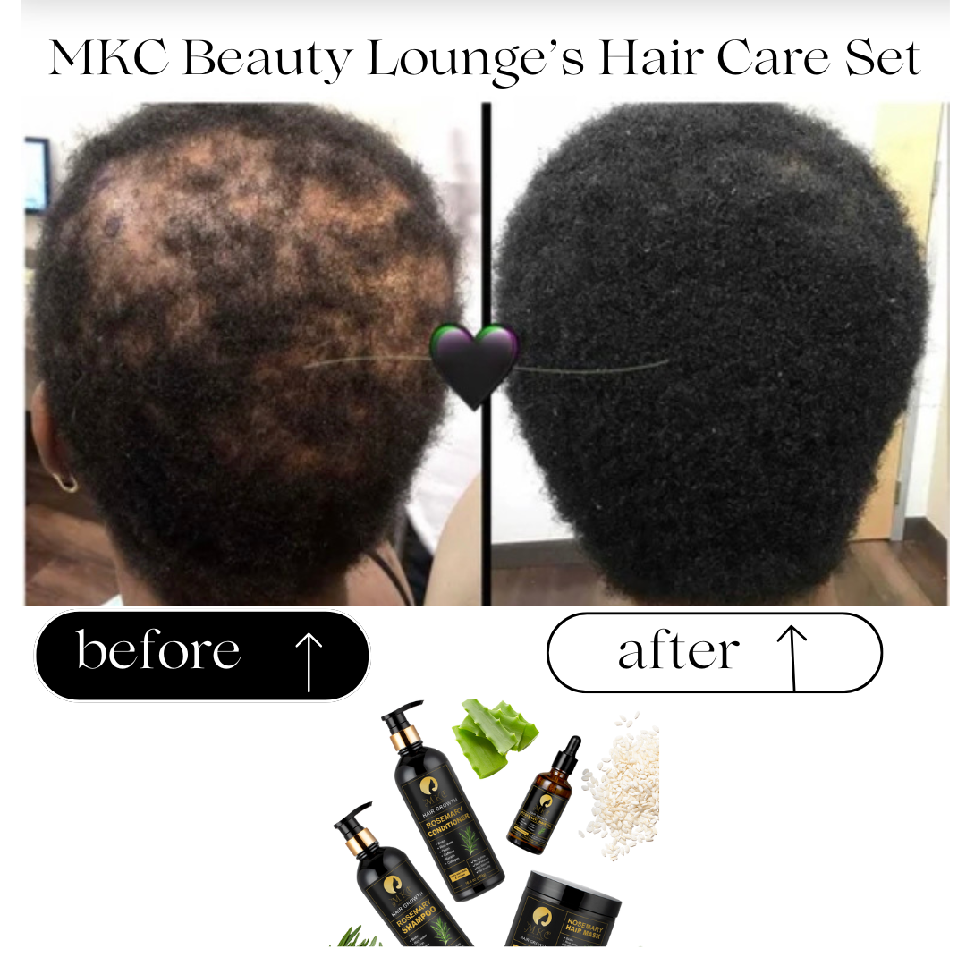 Rosemary Hair Care Set